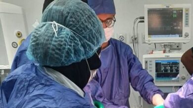 نجاح جراحة دقيقة لمريضة تعاني من التهاب بريتوني حاد وانسداد معوي في المنيا